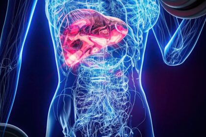 Chyby ktore poskoduju pecen Problemom moze byt aj nespravne pripravena zelenina