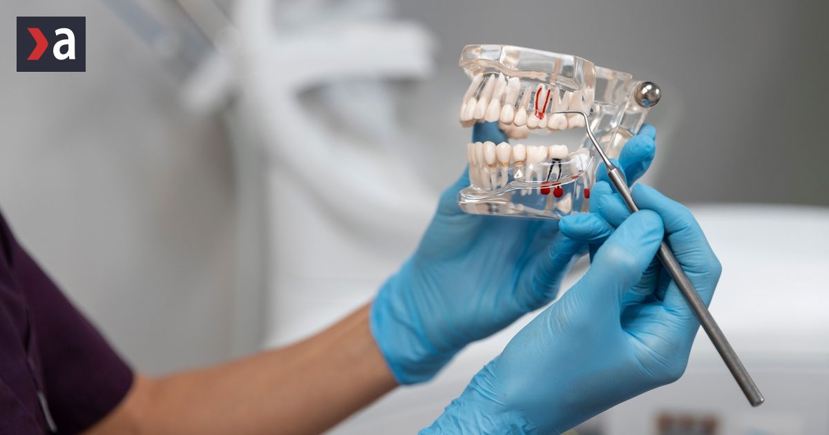 Musi sa trhat zuby mudrosti zubarka vysvetluje kedy je to nevyhnutne