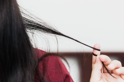 Myslela som si ze som jedina otec sa mi smial Trichotillomania je neviditelny problem