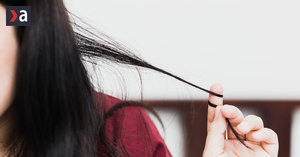 Myslela som si ze som jedina otec sa mi smial Trichotillomania je neviditelny problem