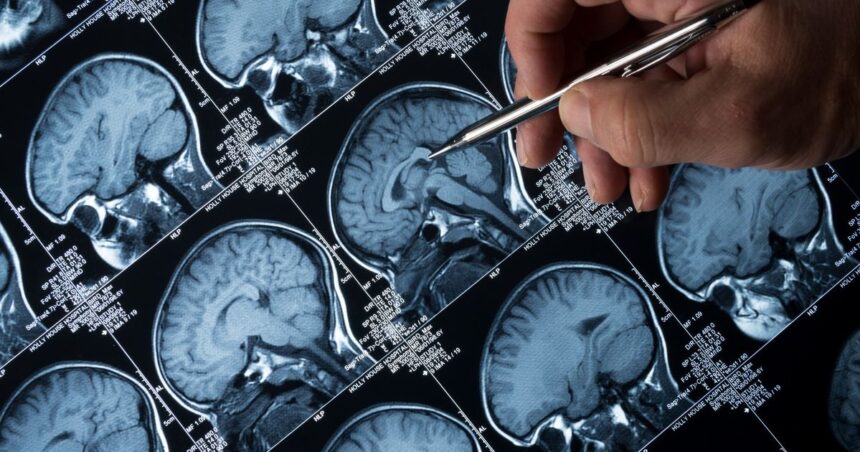 Vedci varuju Umela inteligencia vam potichu prepisuje mozog a ani o tom neviete