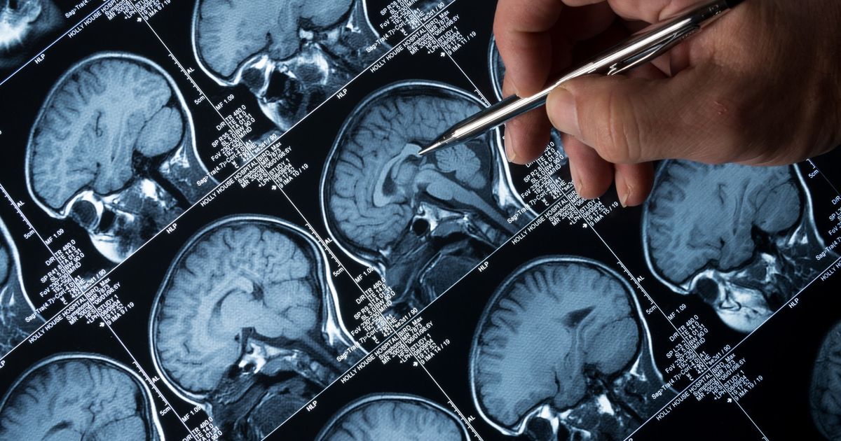 Vedci varuju Umela inteligencia vam potichu prepisuje mozog a ani o tom neviete