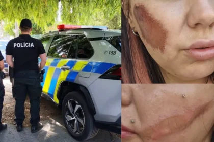 v pripade napadnutych zien z trnavy policia zacala konat po tlaku medii