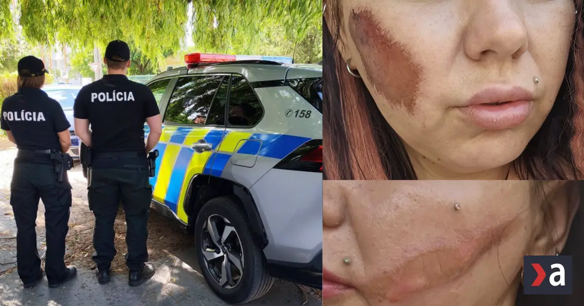 v pripade napadnutych zien z trnavy policia zacala konat po tlaku medii